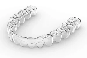 How Invisalign Aligner Tracking Systems Monitor Progress and Predict Treatment Milestones