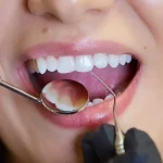 Understanding How Root Canal Therapy Preserves Natural Teeth Through Advanced Endodontic Techniques